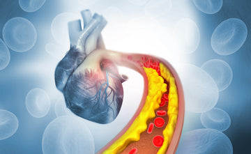 Atherosclerosis