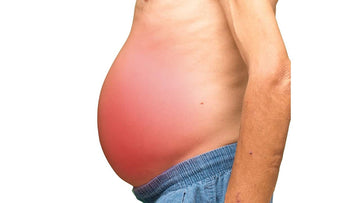 What is Ascites? Symptoms and Ayurvedic Approach for its Treatment