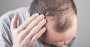 What is Hair Fall? Symptoms, Home Remedies and Ayurvedic Treatment