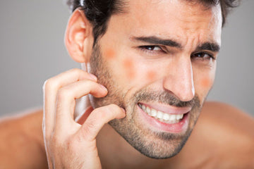 What are Skin Problems? How these skin problems are treated in Ayurveda?