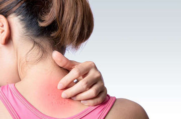 What is Itching? How to cure it Naturally with Ayurveda?