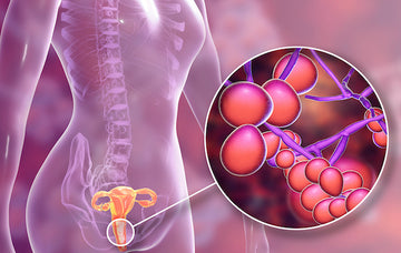 YEAST INFECTION