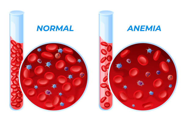 Anemia oxygen deals