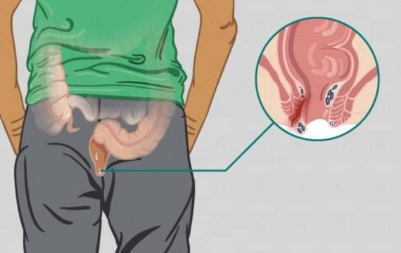 Mening enam porno Shaffof pantiesdagi mushukning fotosurati