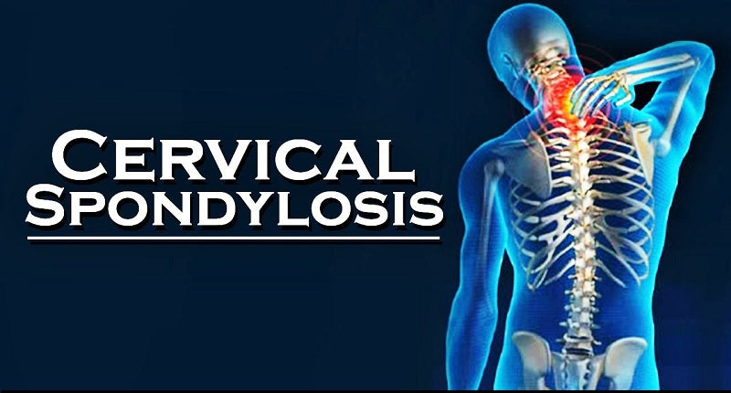 What is Cervical Spondylosis? Cause and its Ayurvedic Treatment