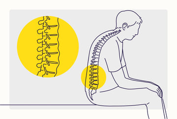 ANKYLOSING SPONDYLITIS