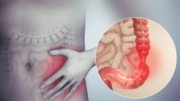 IRRITABLE BOWEL SYNDROME