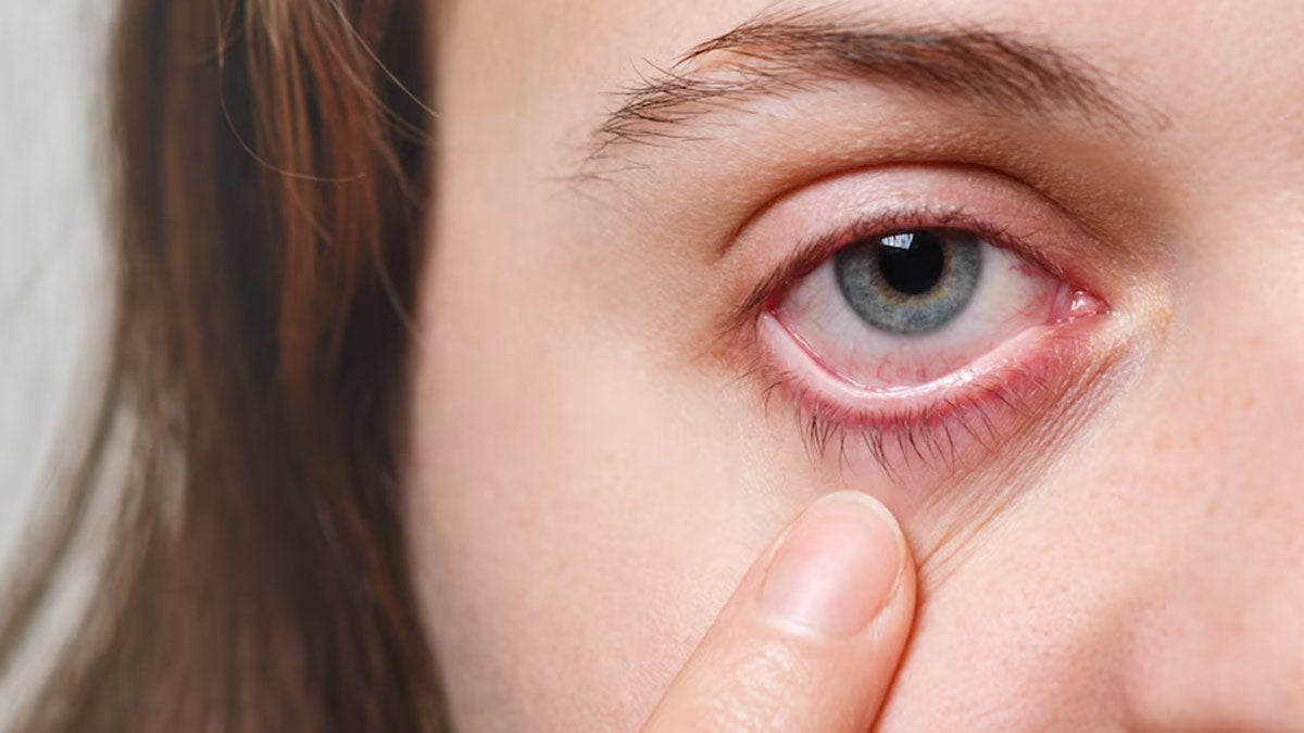 What are chronic eyes disease? How they are cured with the help of ayurveda?