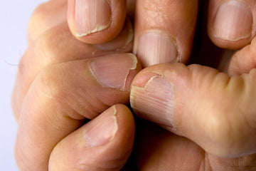 Home Remedies for Brittle Nails