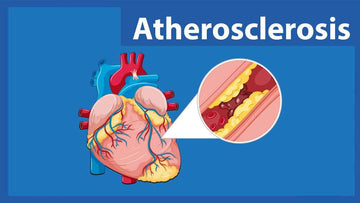 ATHEROSCLEROSIS