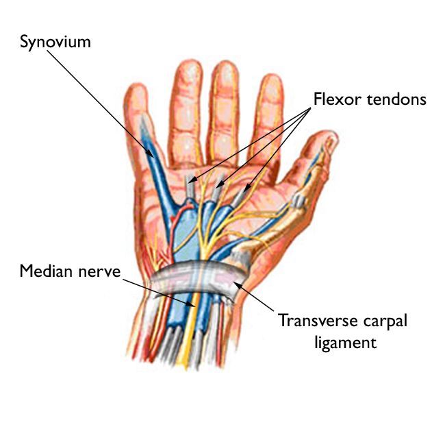 CARPAL TUNNEL SYNDROME