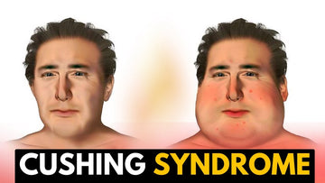 Cushing Syndrome