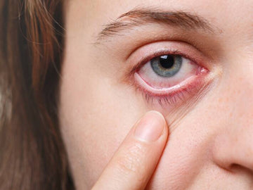 Dry Eye syndrome