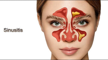 What is Sinusitits? How Ayurveda is helpful in treating Sinus Naturally?