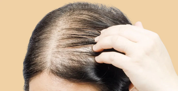 What are the Causes, Prevention and Herbal Remedies for Hair Thining and Hair Loss?