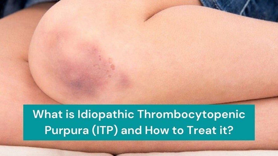 What is Idiopathic Thrombocytopenic Purpura (ITP)? What are the sympto