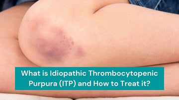 What is Idiopathic Thrombocytopenic Purpura (ITP)? What are the symptoms, causes and its Ayurvedic Treatment?